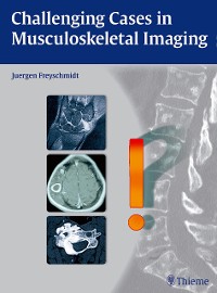 Cover Challenging Cases in Musculoskeletal Imaging