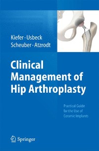 Cover Clinical Management of Hip Arthroplasty