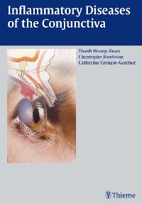 Cover Inflammatory Diseases of the Conjuctiva