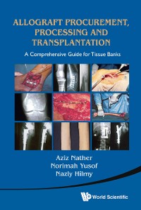 Cover Allograft Procurement, Processing and Transplantation
