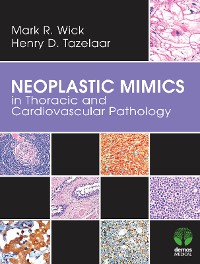 Cover Neoplastic Mimics in Thoracic and Cardiovascular Pathology
