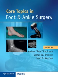 Cover Core Topics in Foot and Ankle Surgery