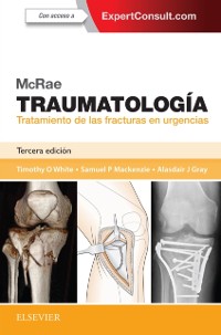 Cover McRae. Traumatología. Tratamiento de las fracturas en urgencias