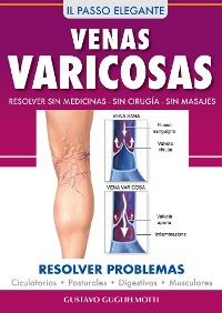 Cover Venas Varicosas - Solución definitiva