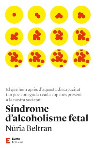 Cover Síndrome d'alcoholisme fetal