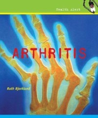 Cover Arthritis