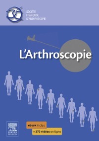 Cover L''arthroscopie