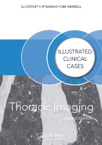 Cover Thoracic Imaging