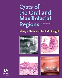Cover Cysts of the Oral and Maxillofacial Regions