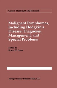Cover Malignant lymphomas, including Hodgkin's disease: Diagnosis, management, and special problems