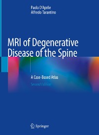 Cover MRI of Degenerative Disease of the Spine