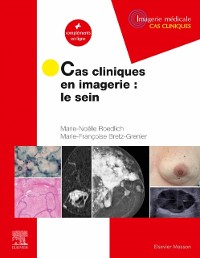 Cover Cas cliniques en imagerie : le sein