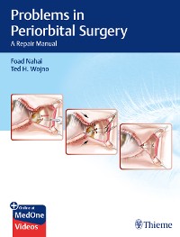 Cover Problems in Periorbital Surgery