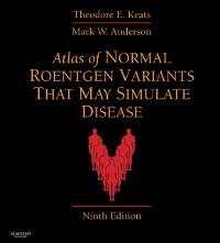 Cover Atlas of Normal Roentgen Variants That May Simulate Disease E-Book