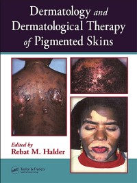 Cover Dermatology and Dermatological Therapy of Pigmented Skins