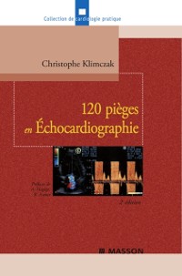 Cover 120 pièges en Échocardiographie