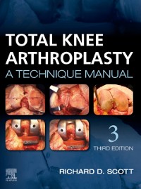 Cover Total Knee Arthroplasty E-Book