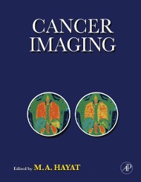 Cover Cancer Imaging