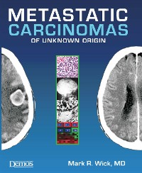 Cover Metastatic Carcinomas of Unknown Origin