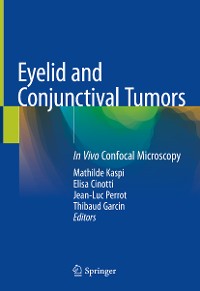 Cover Eyelid and Conjunctival Tumors