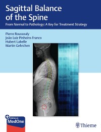 Cover Sagittal Balance of the Spine