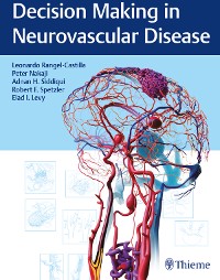 Cover Decision Making in Neurovascular Disease