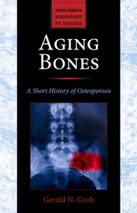 Cover Aging Bones