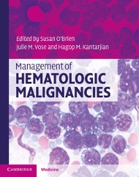 Cover Management of Hematologic Malignancies