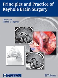 Cover Principles and Practice of Keyhole Brain Surgery