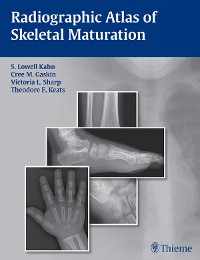 Cover Radiographic Atlas of Skeletal Maturation