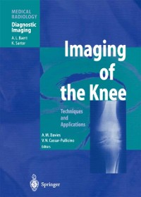 Cover Imaging of the Knee