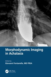 Cover Morphodynamic Imaging in Achalasia