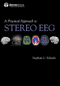 Cover A Practical Approach to Stereo EEG