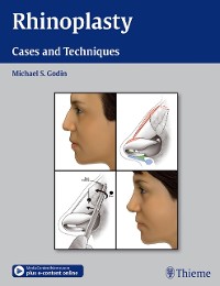 Cover Rhinoplasty