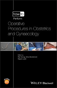 Cover How to Perform Operative Procedures in Obstetrics and Gynaecology