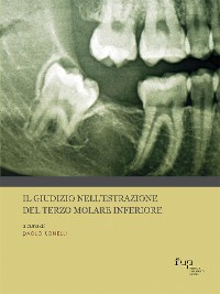 Cover Il giudizio nell’estrazione del terzo molare inferiore