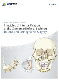 Cover Principles of Internal Fixation of the Craniomaxillofacial Skeleton