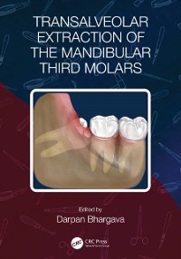 Cover Transalveolar Extraction of the Mandibular Third Molars