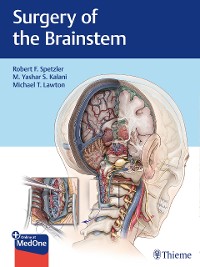 Cover Surgery of the Brainstem