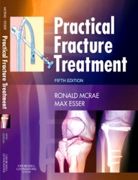 Cover Practical Fracture Treatment E-Book