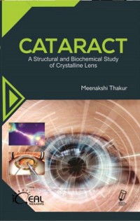 Cover Cataract (A Structural And Biochemical Study Of Crystalline Lens)