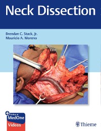 Cover Neck Dissection