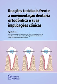 Cover Reações teciduais frente à movimentação dentária ortodóntica e suas implicações clínicas