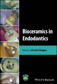 Cover Bioceramics in Endodontics