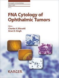 Cover FNA Cytology of Ophthalmic Tumors