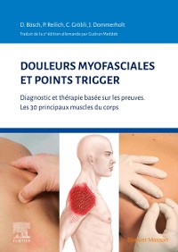 Cover Douleurs myofasciales et points trigger