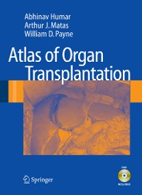 Cover Atlas of Organ Transplantation