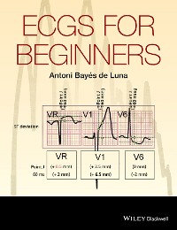 Cover ECGs for Beginners