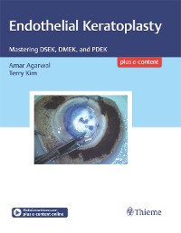 Cover Endothelial Keratoplasty