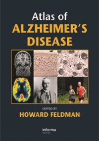 Cover Atlas of Alzheimer''s Disease